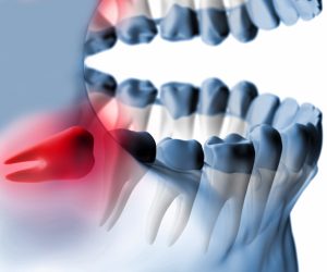 Ağız ve Çene Cerrahisi