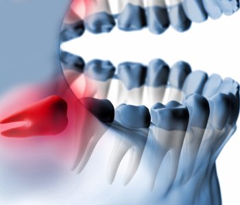 Ağız ve Çene Cerrahisi