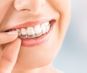 Ortodonti (Diş Teli Tedavisi)