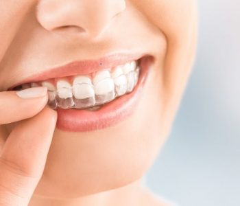 Ortodonti (Diş Teli Tedavisi)