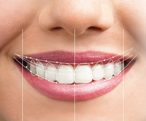 Estetik Diş Hekimliği