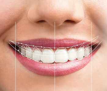 Estetik Diş Hekimliği