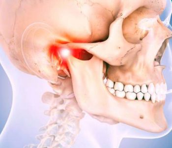 Çene Eklem Hastalıkları Tedavisi